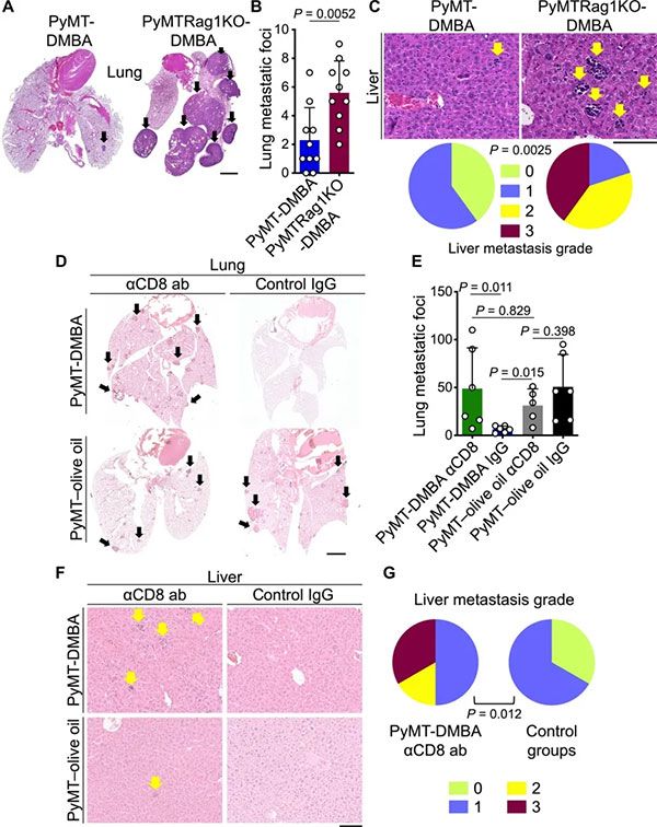3-在DMBA处理的PyMT小鼠中阻断乳腺癌转移需要CD8+-T细胞.jpg