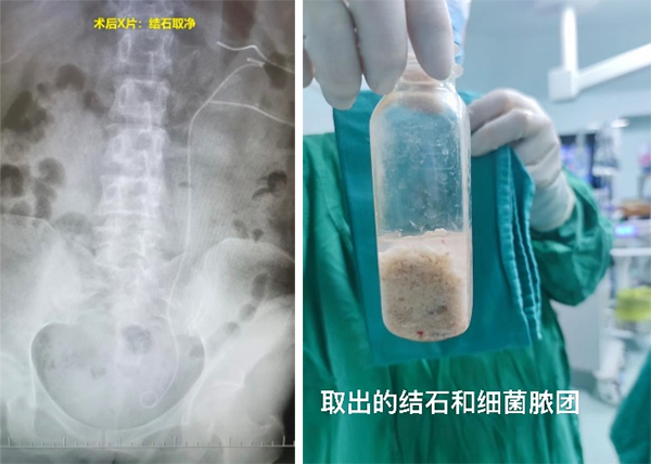 未标题-2.png