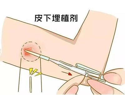 图片3.jpg