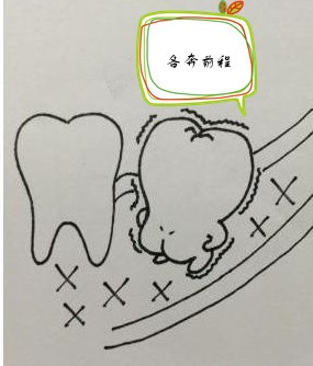牙槽神经1.jpg