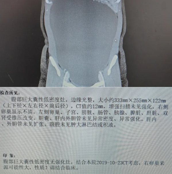 1.png 1.png