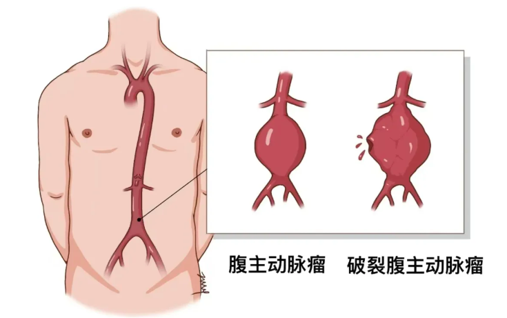 1.png 1.png